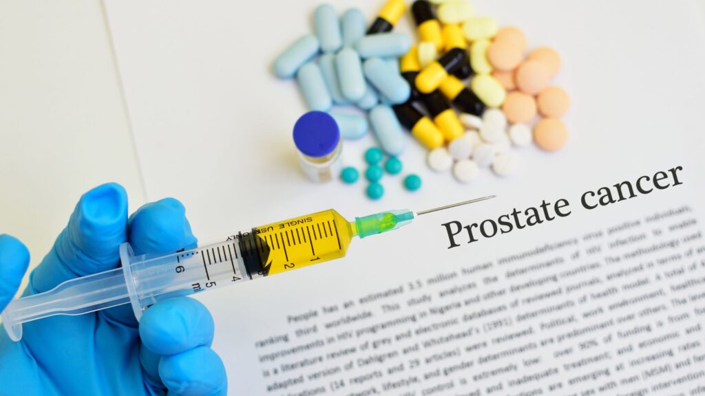 Prostate Cancer diagnosis