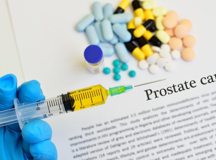 Prostate Cancer diagnosis